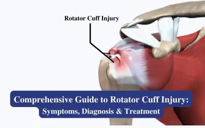 Rotator Cuff Injury